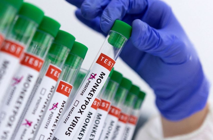  Brasil confirma primeira morte relacionada à varíola dos macacos.