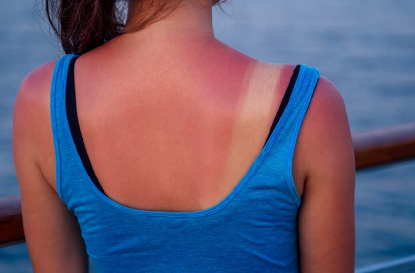  Exposição excessiva ao sol pode prejudicar microbioma da pele, diz estudo.