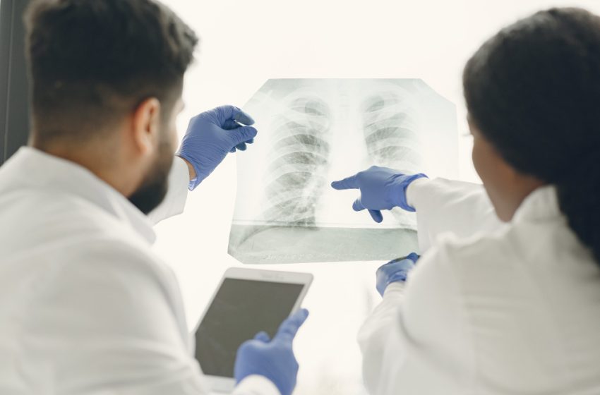  Rastreamento pulmonar pode identificar câncer no início.